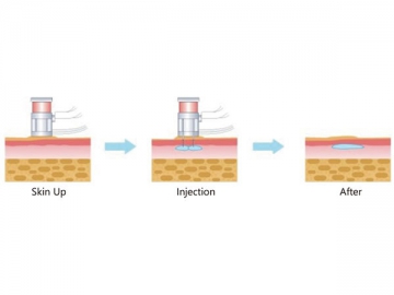 Hydra-Magie-Mesotherapie-Gesichtspflege System