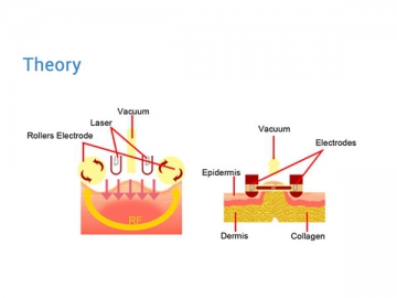 Vacuumformung  (VS  )